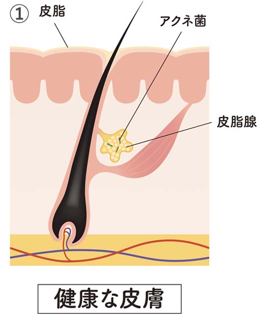 ①健康な皮